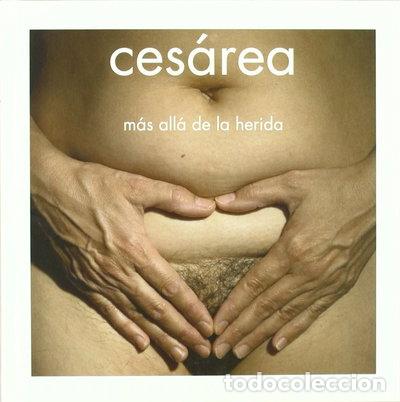 books: Ces&aacute;rea: M&aacute;s All&aacute; de la Herida- 9788493752637