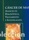 Libros: C&aacute;ncer de mama: avances en diagn&oacute;stico, tratamiento e investigaci&oacute;n- 9788493457839