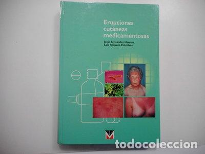 Libri di seconda mano: Erupciones cut&aacute;neas medicamentosas- 9788493163433