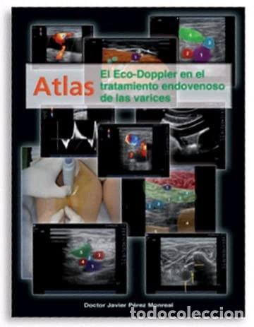 Libri di seconda mano: Atlas El eco-doppler en el tratamiento endovenoso de las varices- 9788493881801