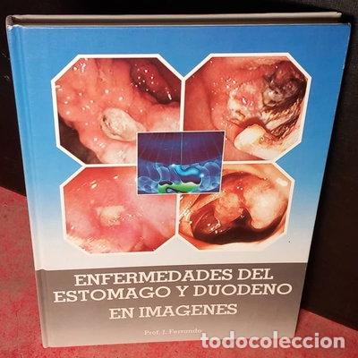 Libros: Enfermedades del est&oacute;mago y duodeno en im&aacute;genes- 9788486917500