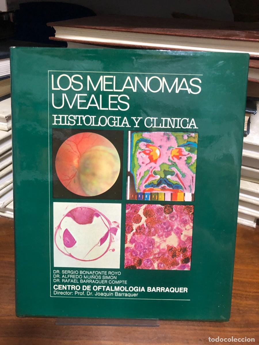 Libros: Los melanomas uveales: Histolog&iacute;a y cl&iacute;nica Dr. Sergio Bonafonte Royo, Dr. Alfredo Mui&ntilde;os Sim&oacute;n, Dr.
