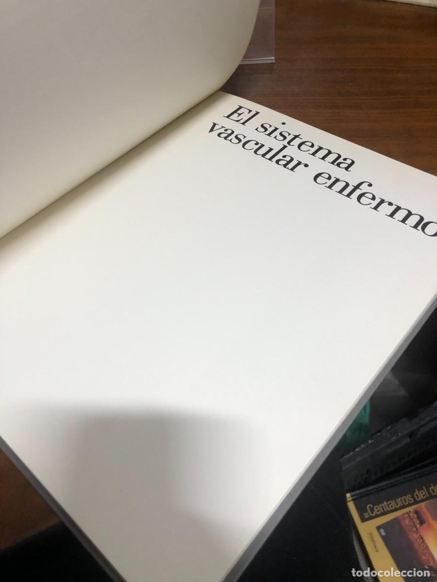 Libros: El sistema vascular enfermo - Foto 2