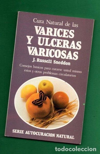 Libros: Cura natural de las varices y &uacute;lceras varicosas- 9788471668431