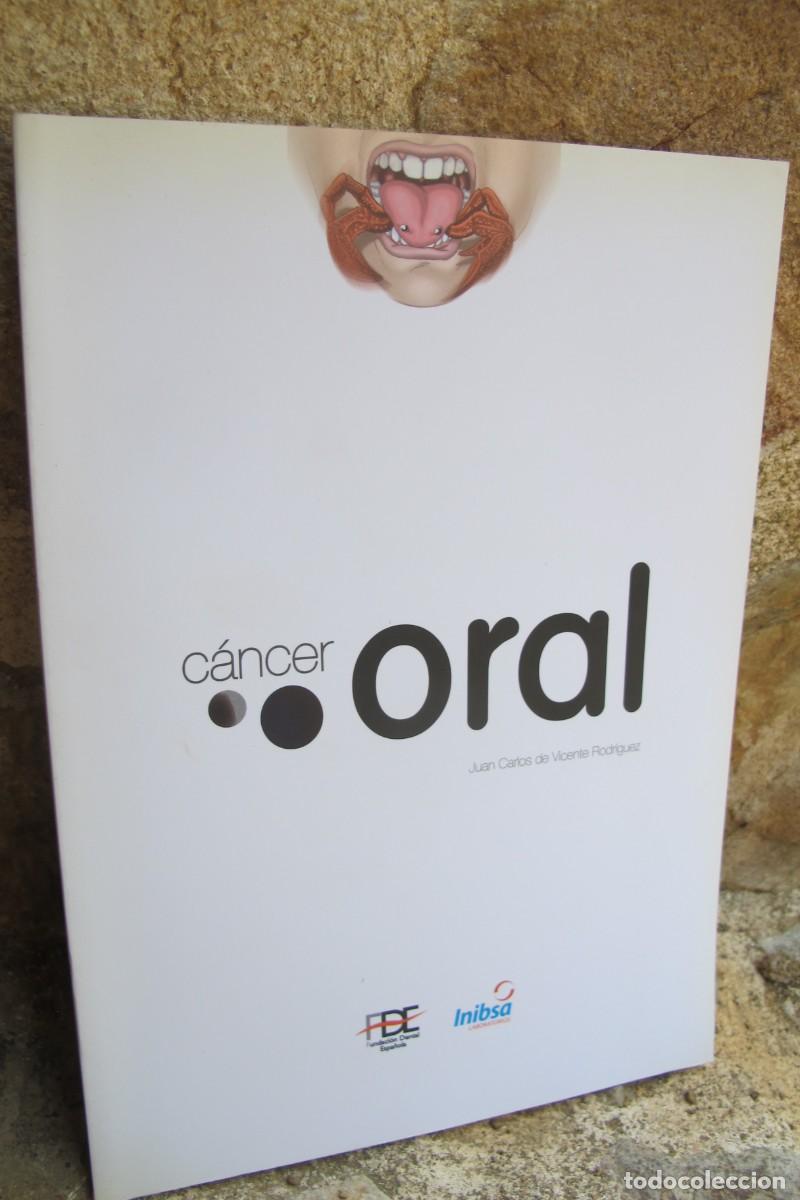 Libros: CANCER ORAL. JUAN CARLOS DE VICENTE RODRIGUEZ
