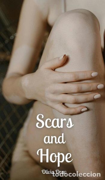Libros: Scars and Hope- 9789916896341