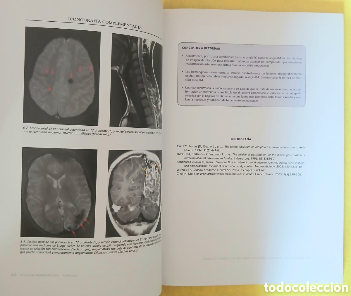 Libros: Cefaleas atlas de neuroimagen - Foto 4