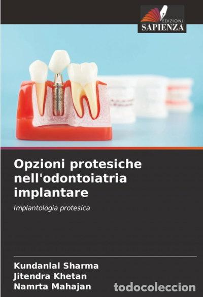 B&uuml;cher: Opzioni protesiche nell'odontoiatria implantare- 9786202421416