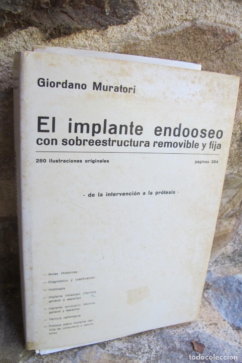 Libros: EL IMPLANTE ENDOOSEO CON SOBREESTRUCTURA REMOVIBLE Y FIJA. GIORDANO MURATORI