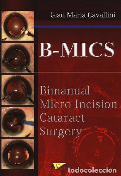 B&uuml;cher: B-MICS Bimanual micro incision cataract surgery- 9788886980920