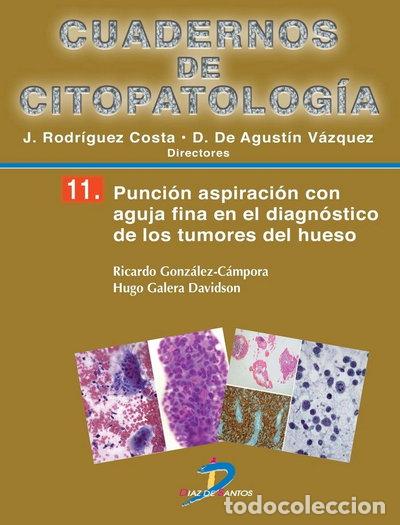 books: Punci&oacute;n aspiraci&oacute;n con aguja fina en el diagn&oacute;stico de los tumores de hueso- 9788499694221