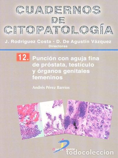 B&uuml;cher: Punci&oacute;n con aguja fina de pr&oacute;stata, test&iacute;culo y &oacute;rganos genitales femeninos- 9788499697826