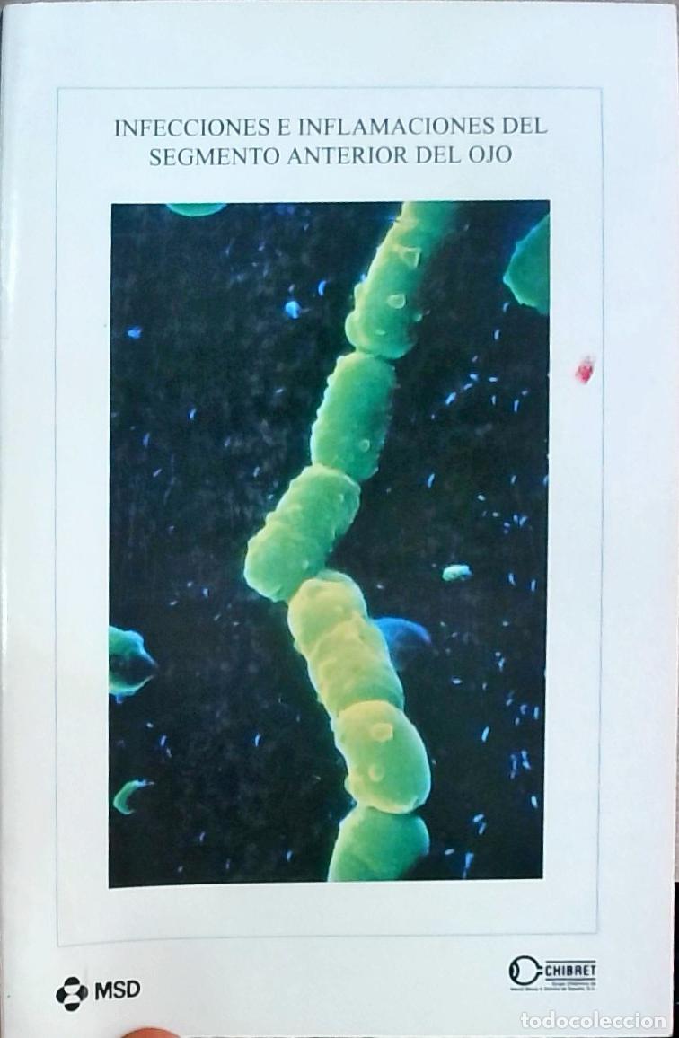 Libri di seconda mano: Infecciones e inflamaciones del segmento anterior del ojo - Autores Varios: