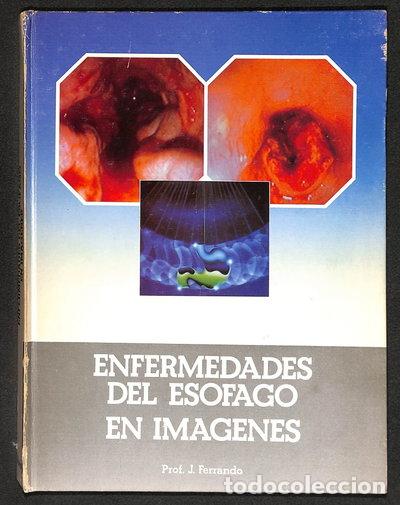 Libros: Enfermedades del es&oacute;fago en im&aacute;genes- 9788486917272