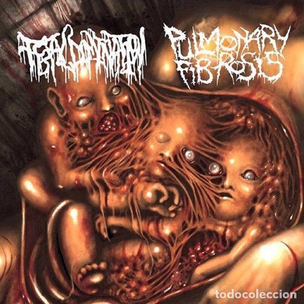 CDs de Musique: Pulmonary Fibrosis, Fetal Domination &ndash; Split Goregrind France / Spain (CD, Base Record...