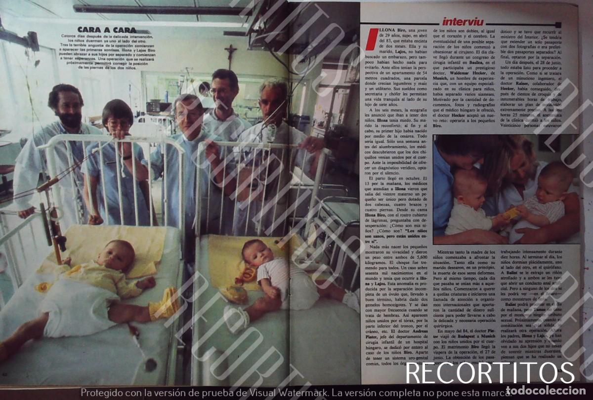 M&uacute;sica de colecci&oacute;n: MELLIZOS SIAMESES MILAGRO - Foto 3