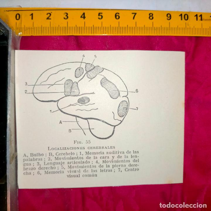 Outros artigos de papel: antiguo grabado medicina enfermedades cuerpo humano salud - CEREBRO