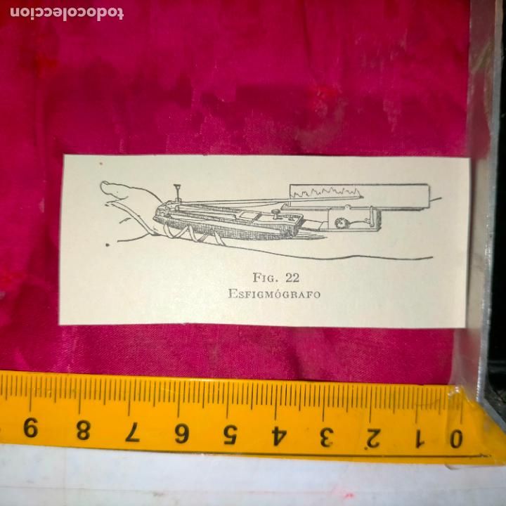 Collectionnisme Papier divers: antiguo grabado medicina enfermedades cuerpo humano salud - ESFIGMOGRAFO