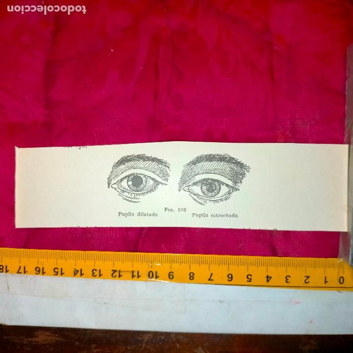Collectionnisme Papier divers: antiguo grabado medicina enfermedades cuerpo humano salud - OJOS PUPILAS