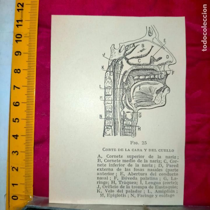 Otros art&iacute;culos de coleccionismo en papel: antiguo grabado medicina enfermedades cuerpo humano salud - CORTE DE LA CARA Y EL CUELLO