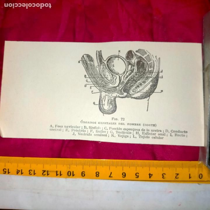 Outros artigos de papel: antiguo grabado medicina enfermedades cuerpo humano salud - ORGANOS GENITALES HOMBRE