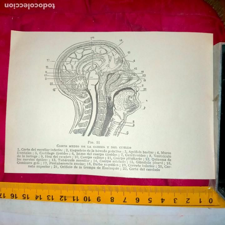Outros artigos de papel: antiguo grabado medicina enfermedades cuerpo humano salud - CORTE CABEZA Y CUELLO