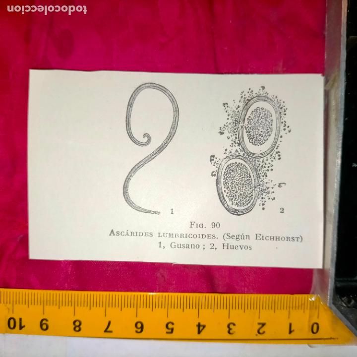 Otros art&iacute;culos de coleccionismo en papel: antiguo grabado medicina enfermedades cuerpo humano salud - ASCARIDES LUMBRICOIDES