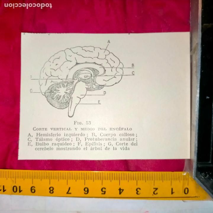 Otros art&iacute;culos de coleccionismo en papel: antiguo grabado medicina enfermedades cuerpo humano salud - ENCEFALO CORTE - CEREBRO