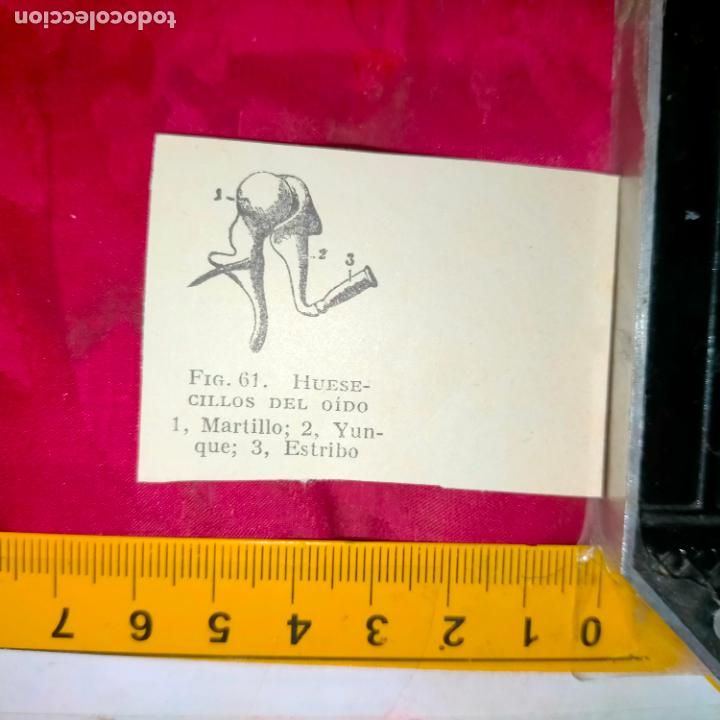Otros art&iacute;culos de coleccionismo en papel: antiguo grabado medicina enfermedades cuerpo humano salud - HUESOS HUESECILLOS DEL OIDO