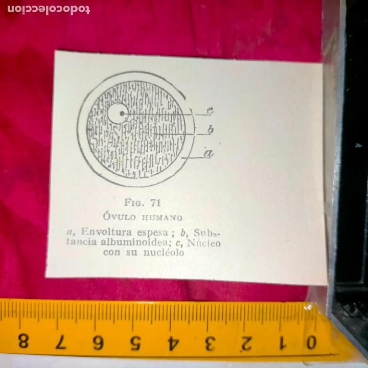 Outros artigos de papel: antiguo grabado medicina enfermedades cuerpo humano salud - OVULO HUMANO