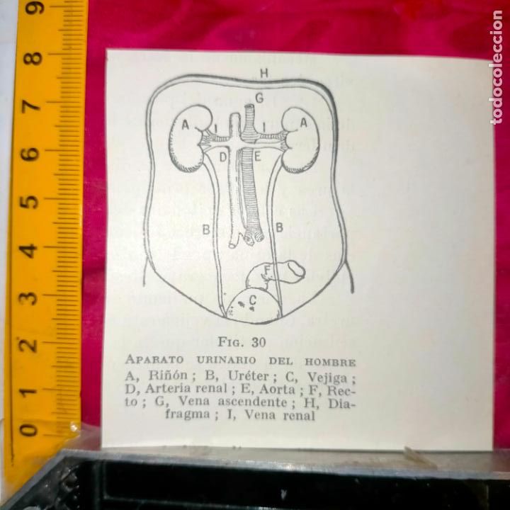 Outros artigos de papel: antiguo grabado medicina enfermedades cuerpo humano salud - APARATO URINARIO DEL HOMBRE