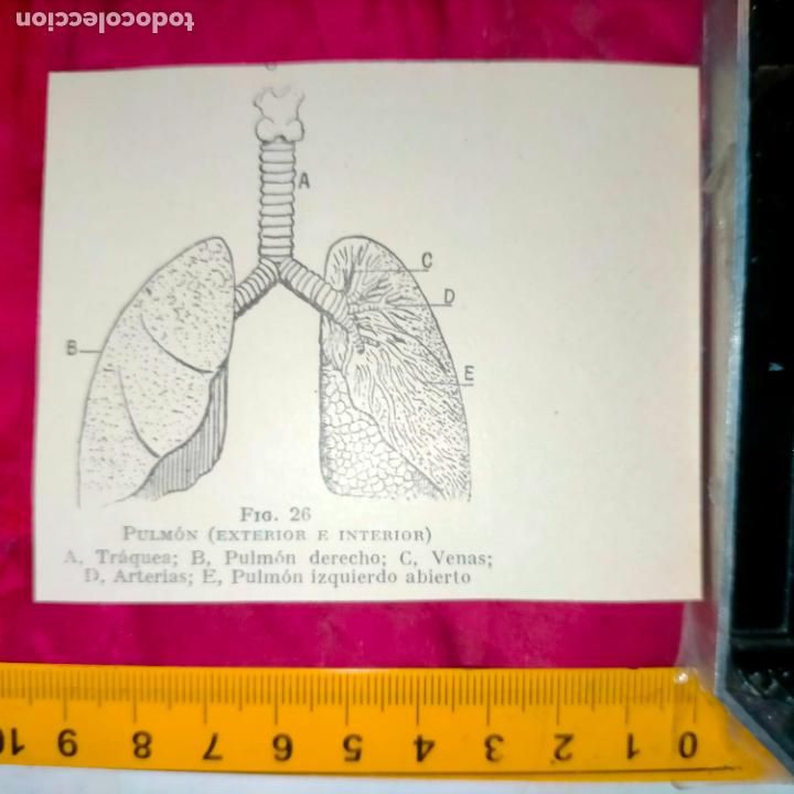 Outros artigos de papel: antiguo grabado medicina enfermedades cuerpo humano salud - PULMONES