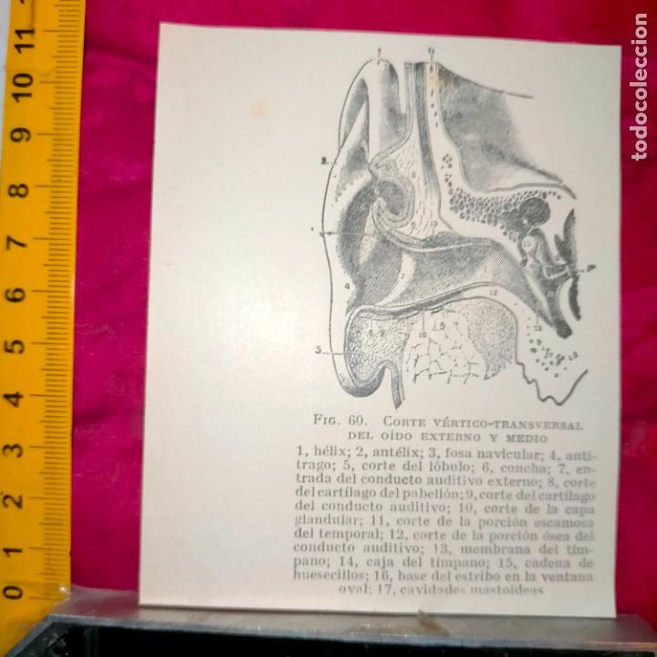 Outros artigos de papel: antiguo grabado medicina enfermedades cuerpo humano salud - OIDO EXTERNO Y MEDIO