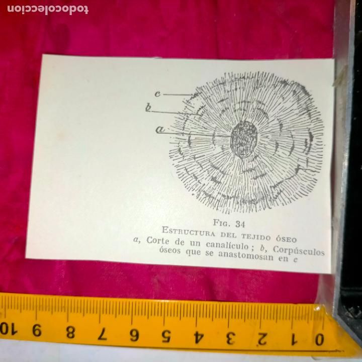 Outros artigos de papel: antiguo grabado medicina enfermedades cuerpo humano salud - ESTRUCTURAS DEL TEJIDO OSEO