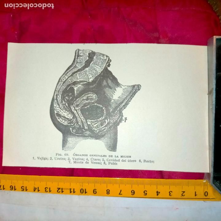 Outros artigos de papel: antiguo grabado medicina enfermedades cuerpo humano salud - ORGANOS GENITALES DE LA MUJER