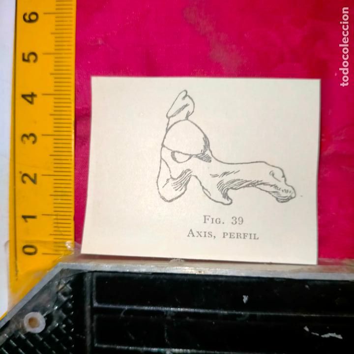 Outros artigos de papel: antiguo grabado medicina enfermedades cuerpo humano salud - AXIS