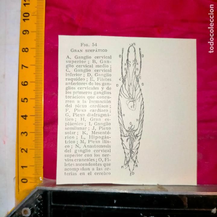 Outros artigos de papel: antiguo grabado medicina enfermedades cuerpo humano salud - GRAN SIMPATICO . GANGLIOS