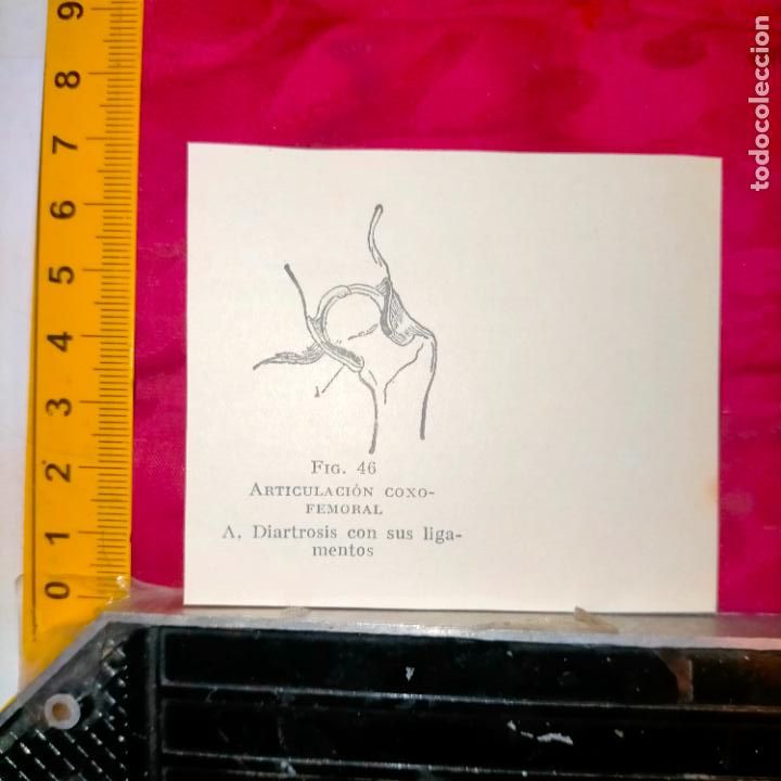 Outros artigos de papel: antiguo grabado medicina enfermedades cuerpo humano salud - ARTICULACION COXOFEMORAL