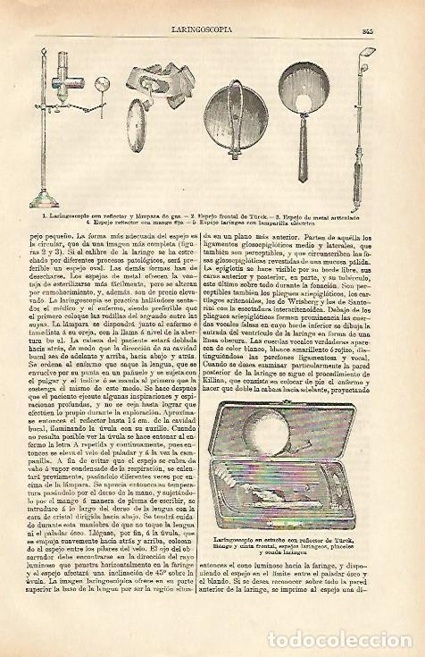 Otros art&iacute;culos de coleccionismo en papel: LAMINA ESPASA 26416: Instrumentos para laringoscopias - Varios