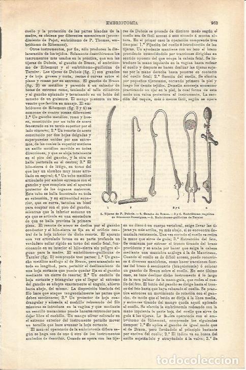Otros art&iacute;culos de coleccionismo en papel: LAMINA ESPASA 35636: Utensilios quirurgicos - Varios