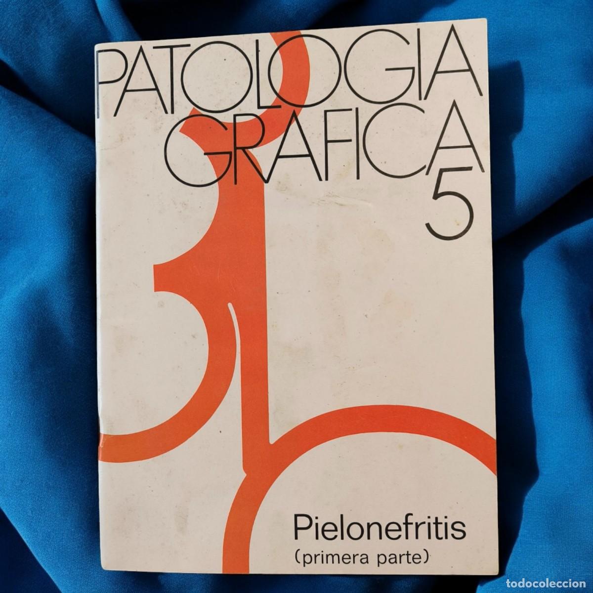 Otros Art&iacute;culos de Coleccionismo en Papel: Patolog&iacute;a Gr&aacute;fica 5 Pielonefritis Primera Parte &ndash; Publicaci&oacute;n M&eacute;dica Madaus
