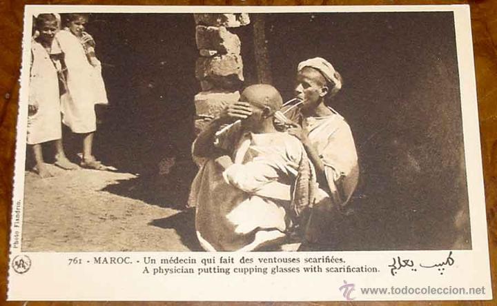 Postais: ANTIGUA POSTAL DE MARRUECOS - UN MEDECIN QUI FAIT DES VENTOUSES SCARIFIEES - PAR M. FLANDRIN - SCENE