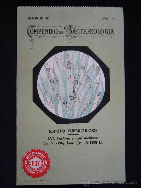 Postcards: Postal Serie 11. Compedio de Bacteriologia. Esputp Tuberculoso. J.M. Arnau.
