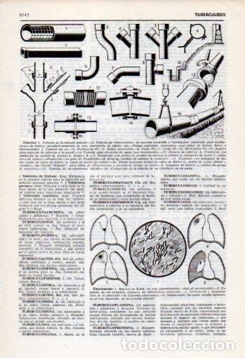 Postcards: LAMINA V35890: Tipos de tuberias y tuberculosis - Varios