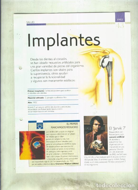 Postales: Implantes: son 4 paginas y - varios