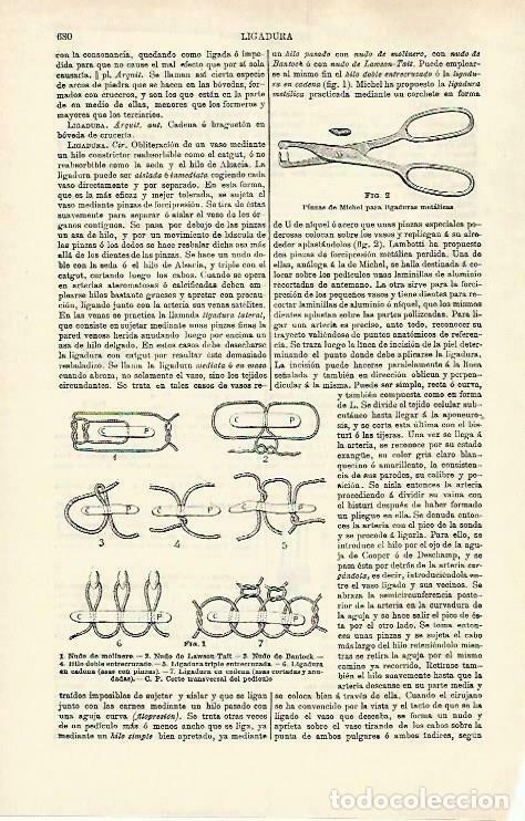 Postkarten: LAMINA ESPASA 33267: Pinzas de Michel y nudos - Varios