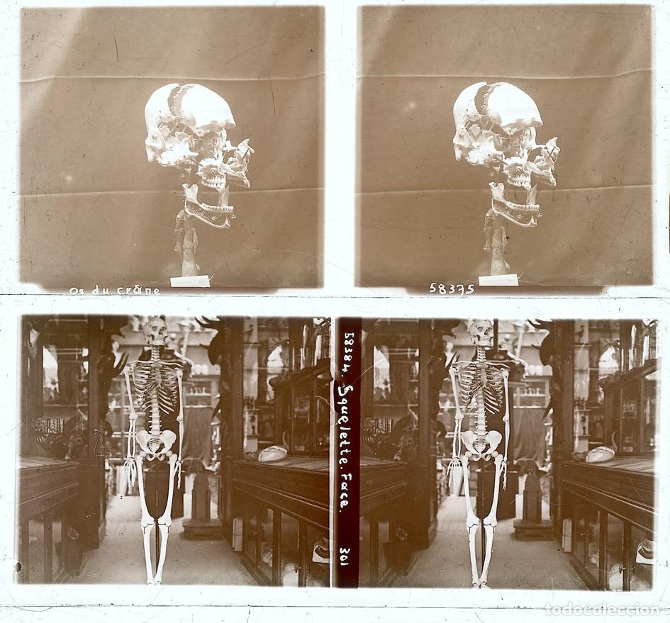 Fon&oacute;grafos e gravadores de v&aacute;lvulas: ANATOMIA 4 CRISTALES ESTEREOSCOPICOS FORMATO 6 X 13 cm.