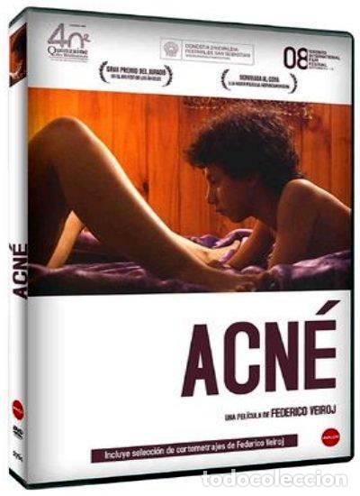 Series de TV: Acne - Foto 1