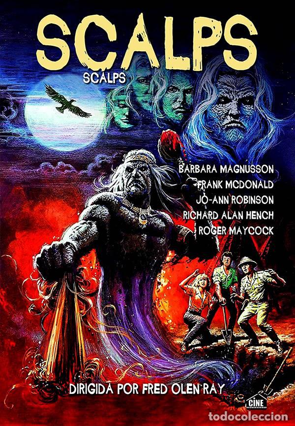 Series de TV: Scalps