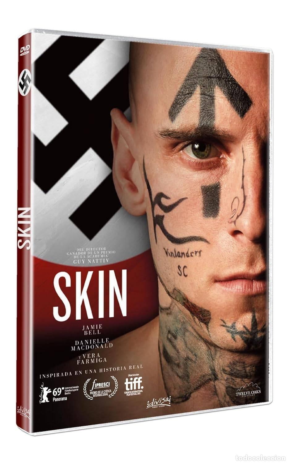 Series de TV: Skin - Foto 1